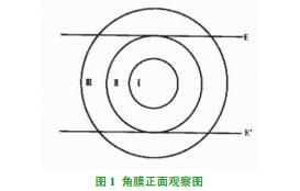 \ՄĤօ^ּR