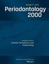 PERIODONTOLOGY 2000пԺօ^