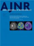 AMERICAN JOURNAL OF NEURORADIOLOGYs־пԺׅ^