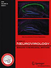 JOURNAL OF NEUROVIROLOGYпԺօ^